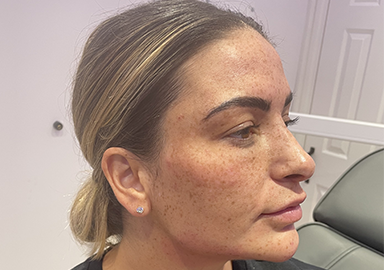 https://www.priyeshladaesthetics.co.uk/wp-content/uploads/2023/04/a-case3.png
