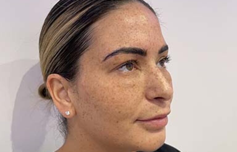 Facial Aesthetics – Before
