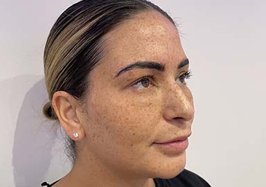 https://www.priyeshladaesthetics.co.uk/wp-content/uploads/2023/04/case3aft.jpg